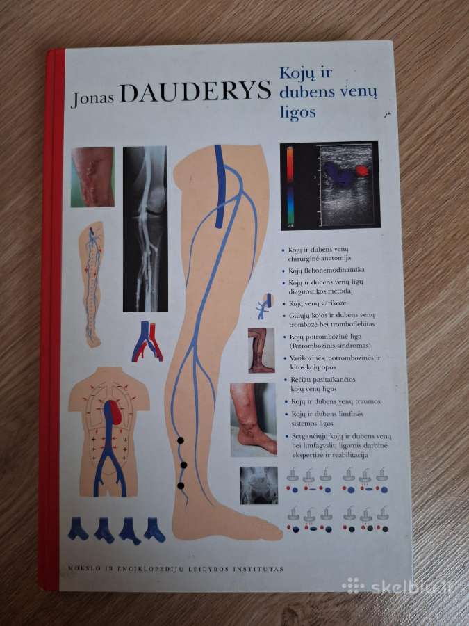 Kojų ir dubens venų ligos. J. Dauderys 2004m.