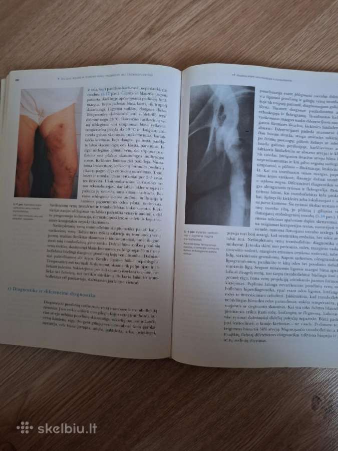 Kojų ir dubens venų ligos. J. Dauderys 2004m. - nuotraukos Nr. 7