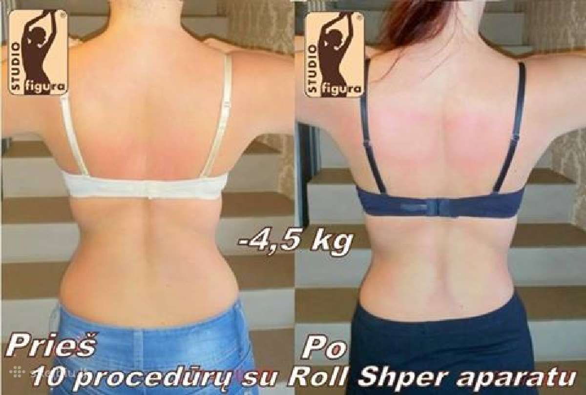 Roll Shaper nuoma Lietuvoje - nuotraukos Nr. 7