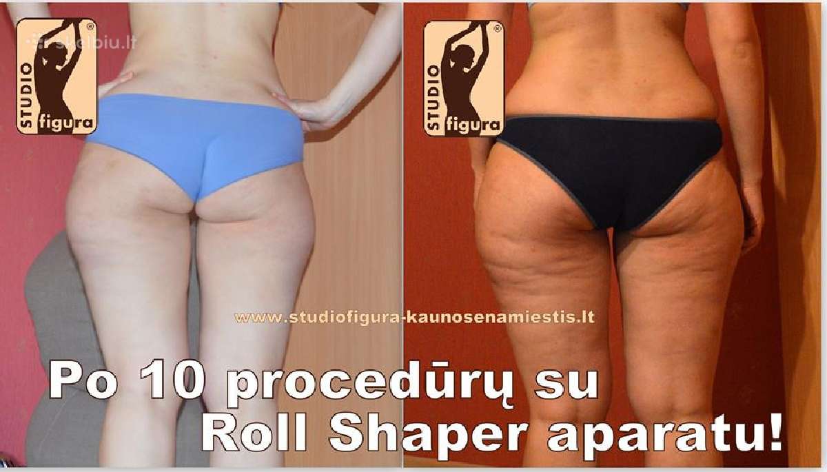 Roll Shaper nuoma Lietuvoje - nuotraukos Nr. 8