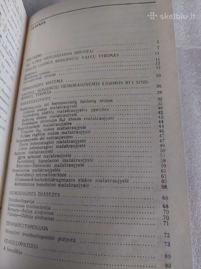 Vaikų kraujo ligos - nuotraukos Nr. 4