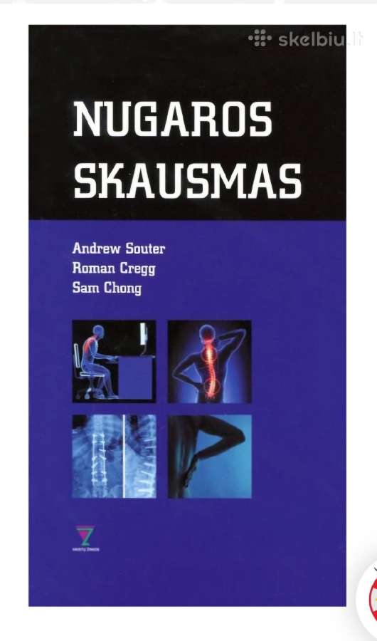 Nugaros skausmas