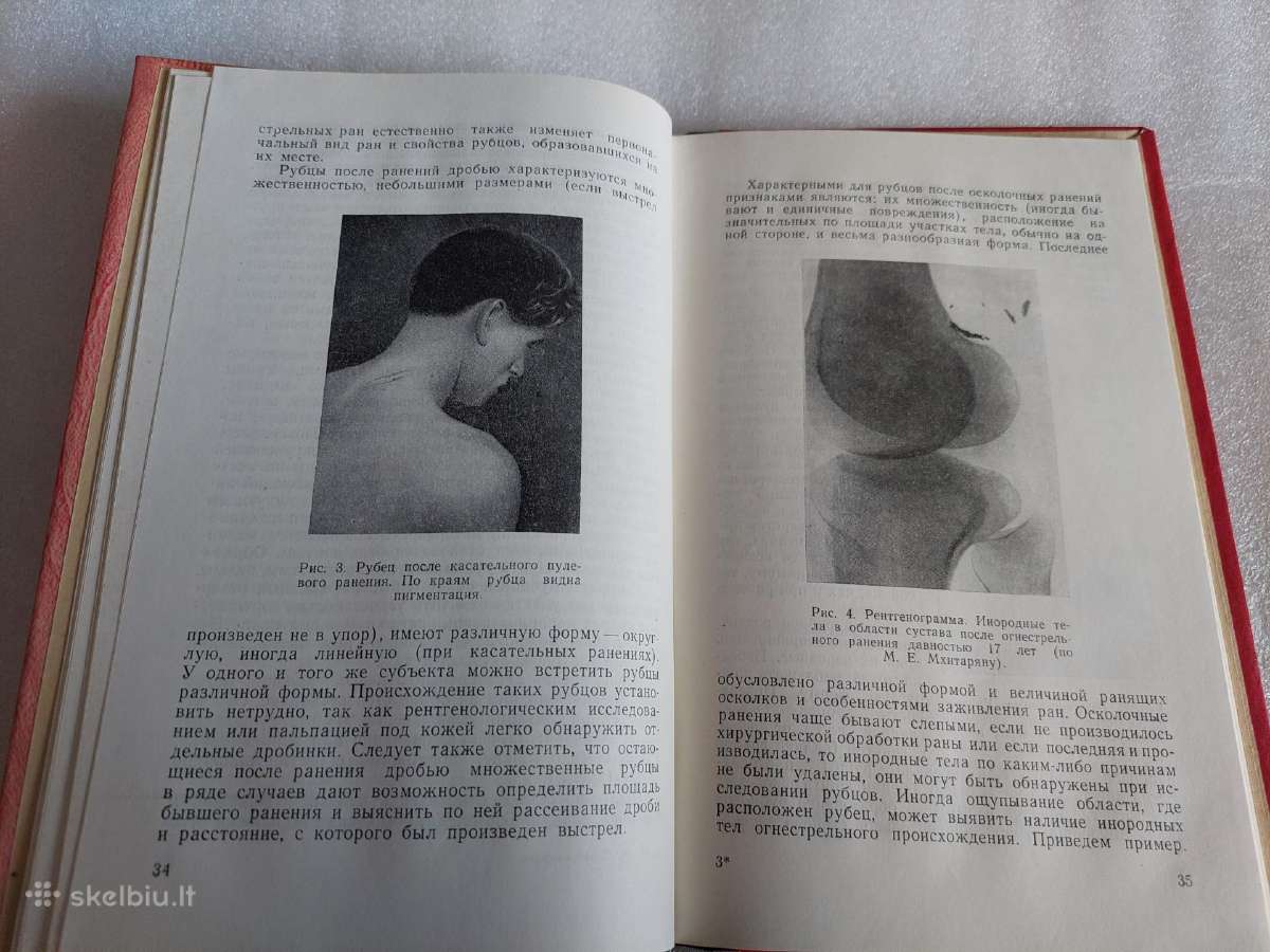 Судебномедицинское исследование рубцов кожи - nuotraukos Nr. 4