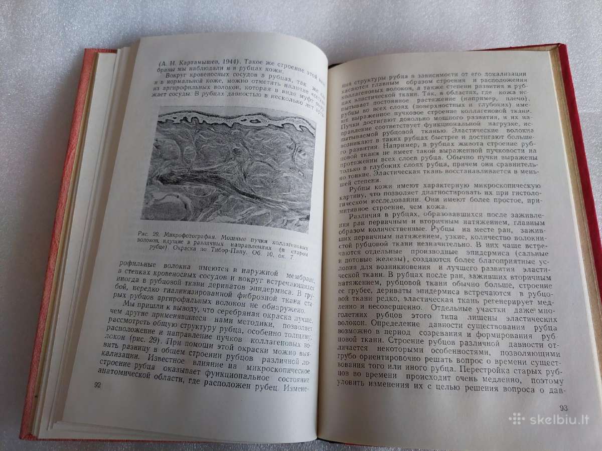 Судебномедицинское исследование рубцов кожи - nuotraukos Nr. 5