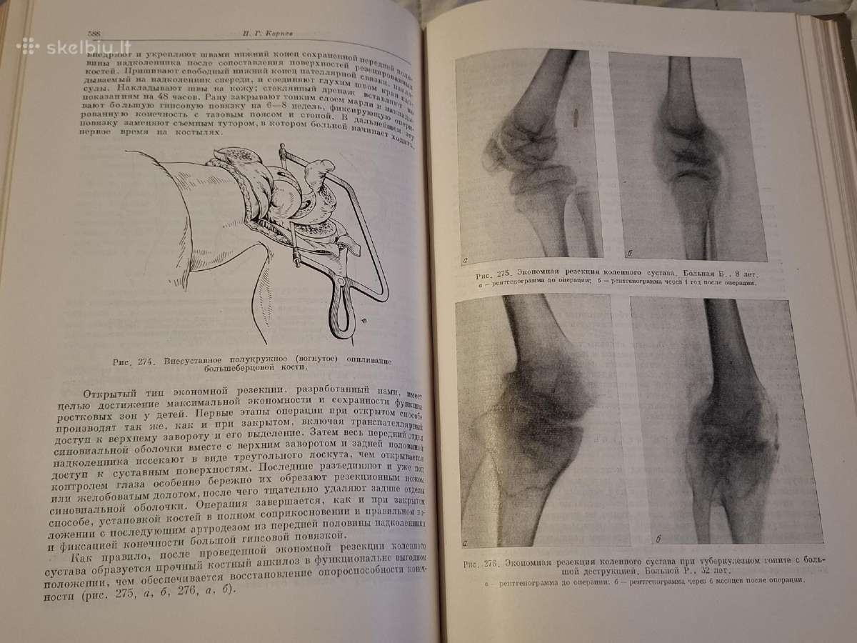 Ortopedijos ir traumatologijos vadovas - nuotraukos Nr. 5