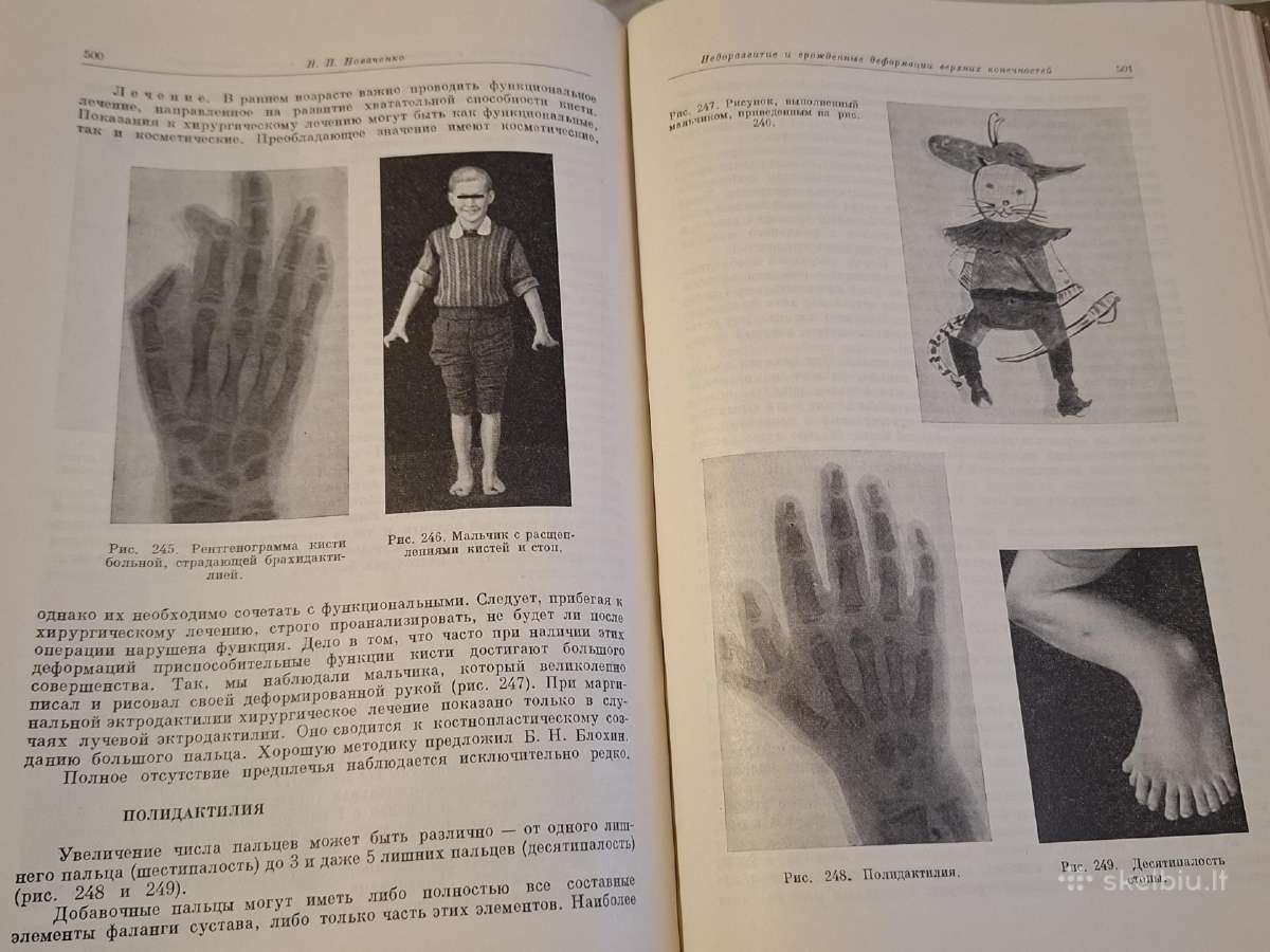 Ortopedijos ir traumatologijos vadovas - nuotraukos Nr. 10