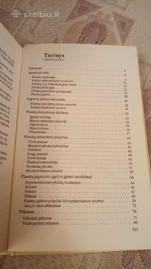 Plaukų ligos - nuotraukos Nr. 3