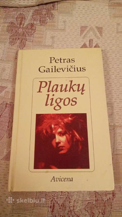 Plaukų ligos