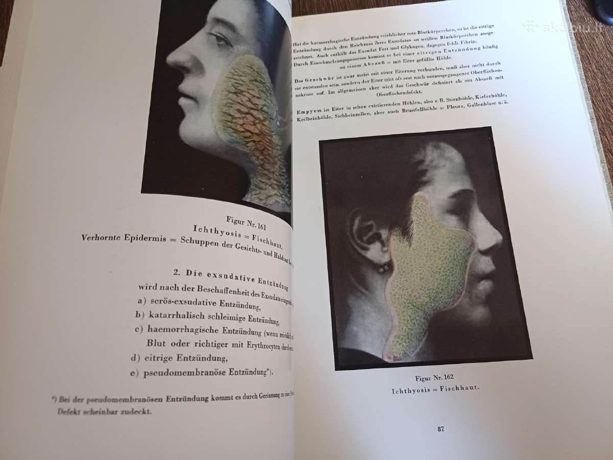 Parduodu knyga,medicinos/odontologijos atlasas1937 - nuotraukos Nr. 7