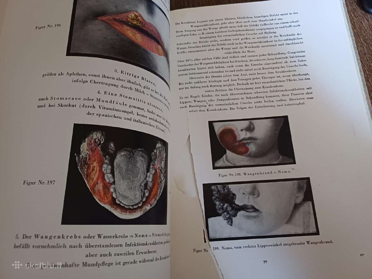 Parduodu knyga,medicinos/odontologijos atlasas1937 - nuotraukos Nr. 13