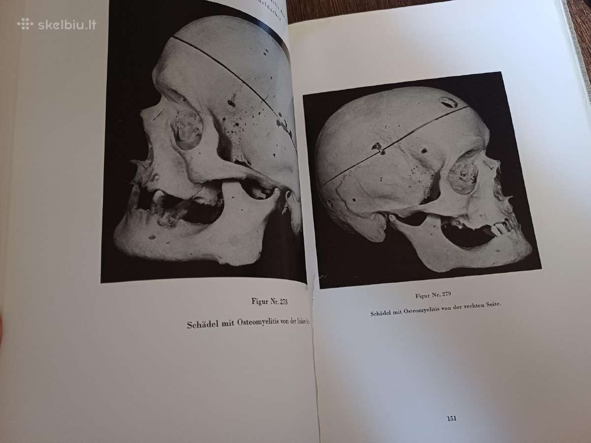 Parduodu knyga,medicinos/odontologijos atlasas1937 - nuotraukos Nr. 5