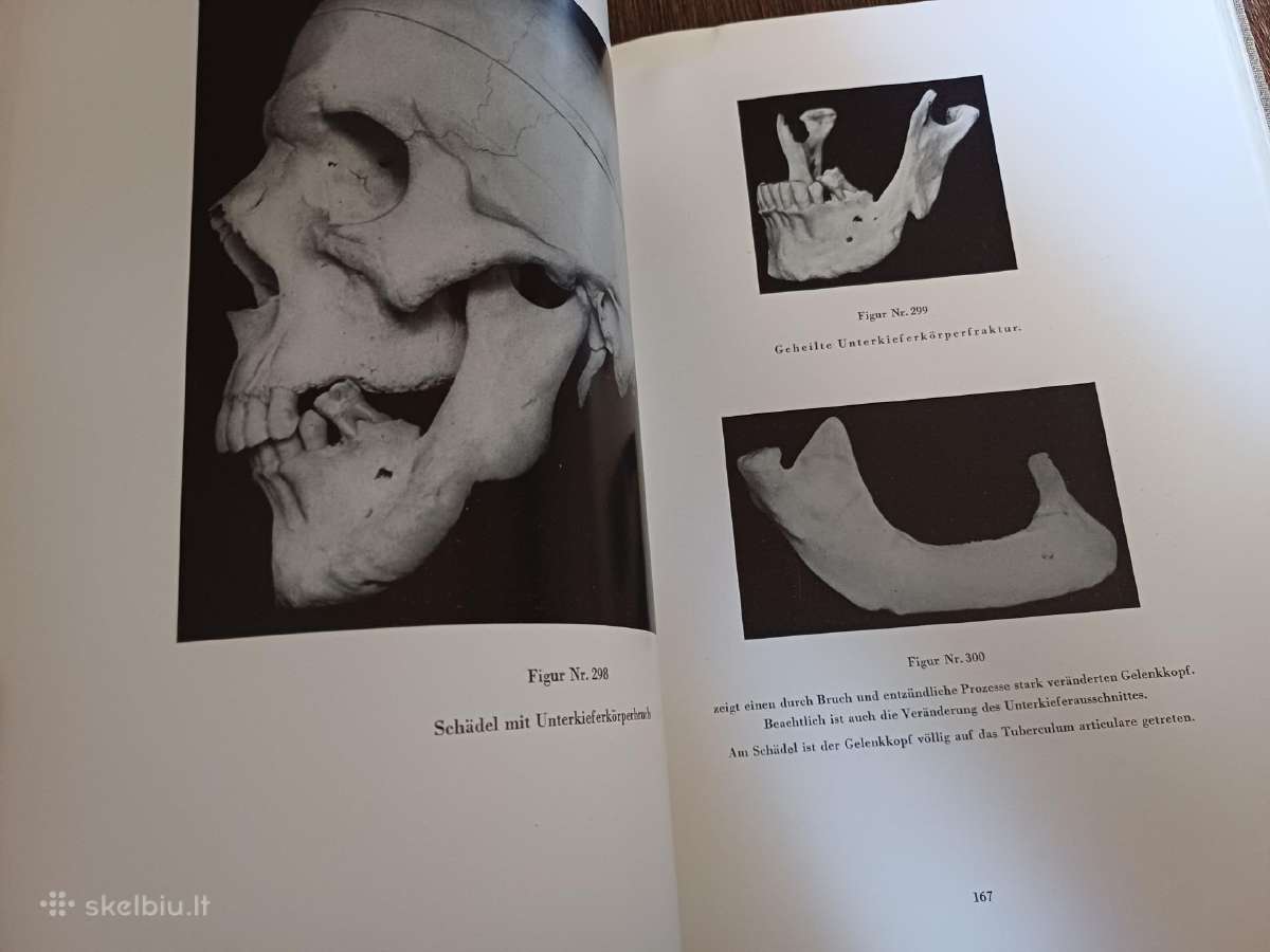 Parduodu knyga,medicinos/odontologijos atlasas1937 - nuotraukos Nr. 20