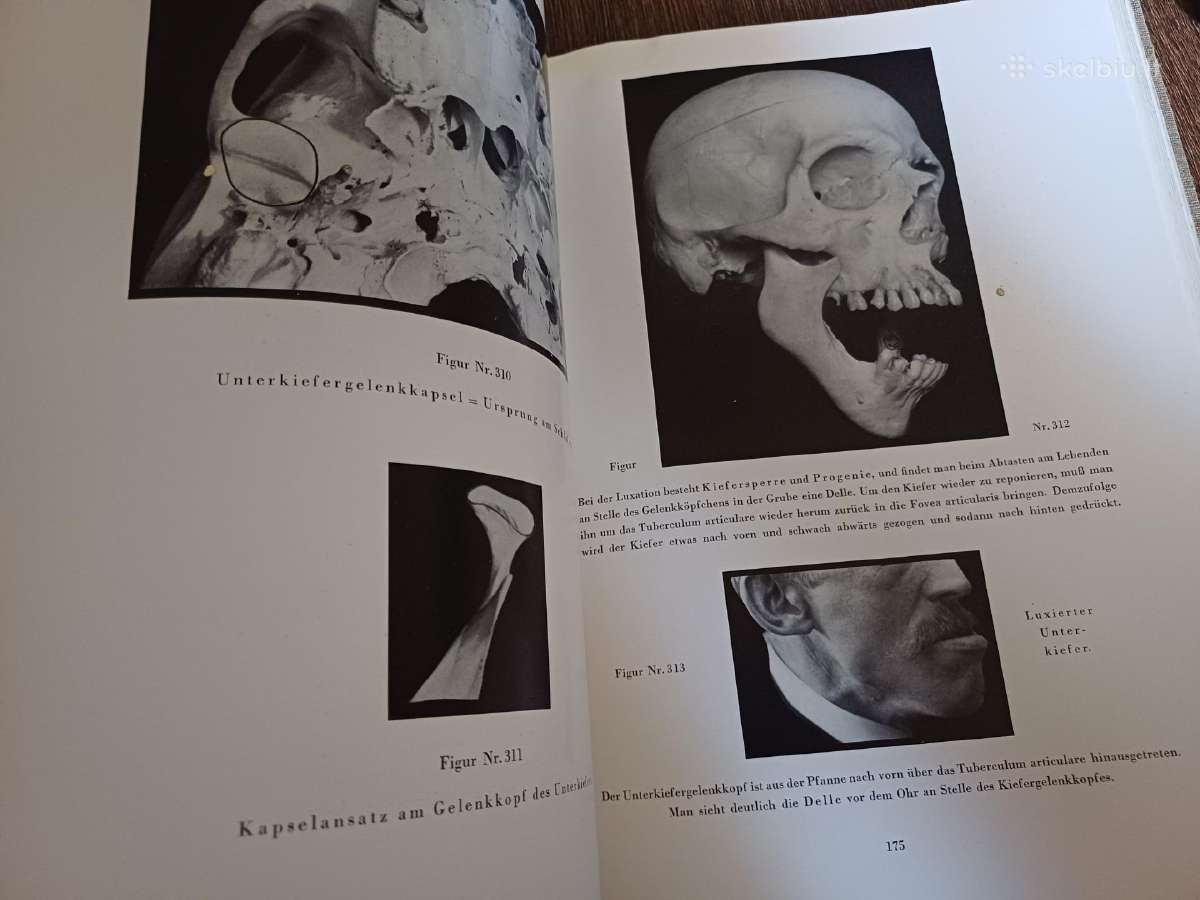Parduodu knyga,medicinos/odontologijos atlasas1937 - nuotraukos Nr. 21