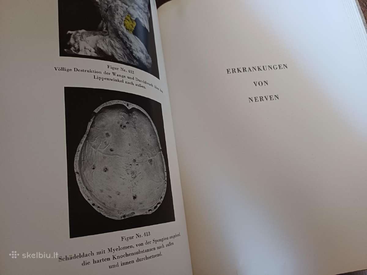 Parduodu knyga,medicinos/odontologijos atlasas1937 - nuotraukos Nr. 24