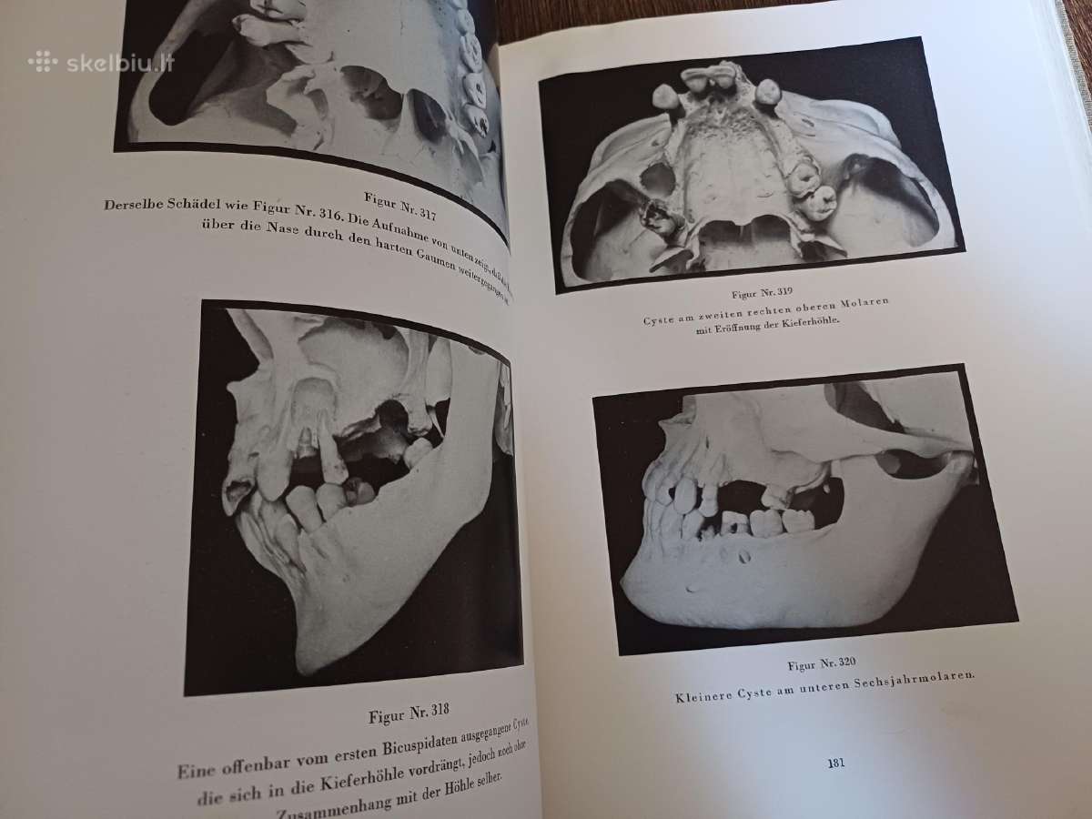 Parduodu knyga,medicinos/odontologijos atlasas1937 - nuotraukos Nr. 30