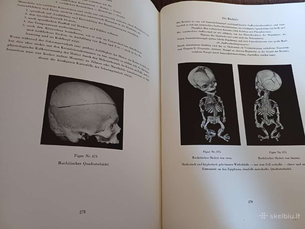 Parduodu knyga,medicinos/odontologijos atlasas1937 - nuotraukos Nr. 32