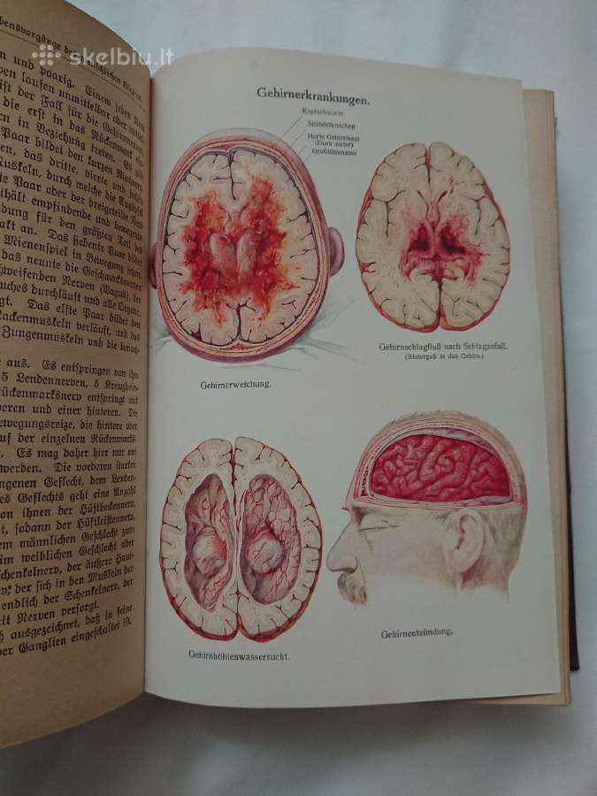 Knyga 1923 metu, Gydytojas Namuose,vokieciu Kalba - nuotraukos Nr. 4