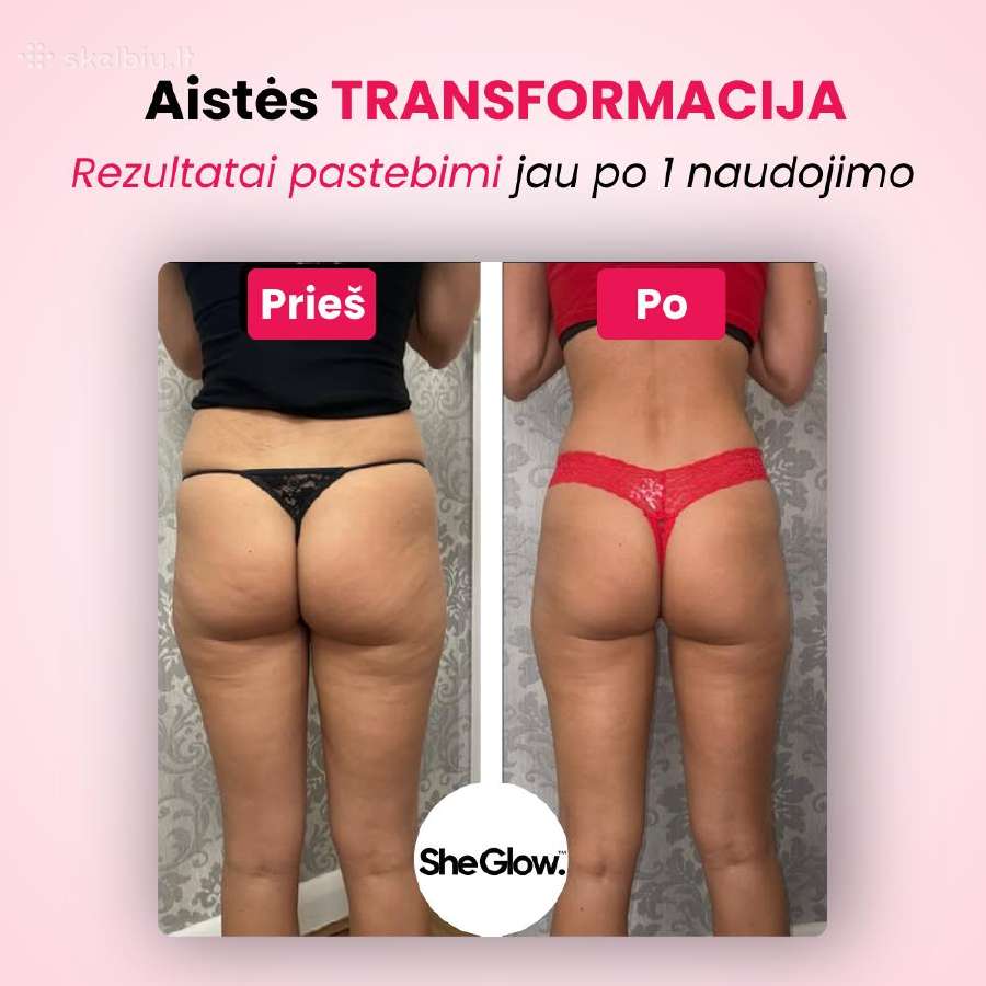 She Glow Pro anticeliulito aparatas - nuotraukos Nr. 5