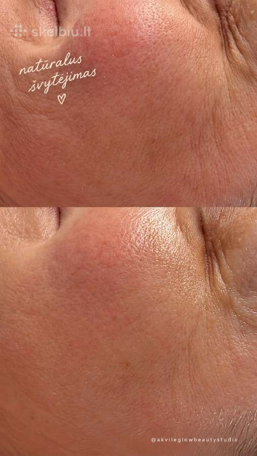 Akvile Glow Beauty Studio Grožio Paslaugos Kaune - nuotraukos Nr. 9