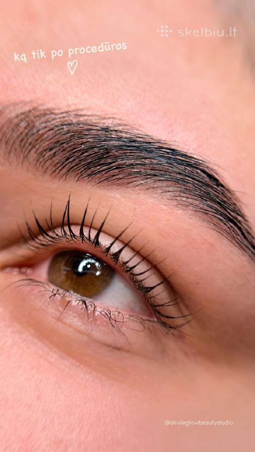 Akvile Glow Beauty Studio Grožio Paslaugos Kaune - nuotraukos Nr. 10