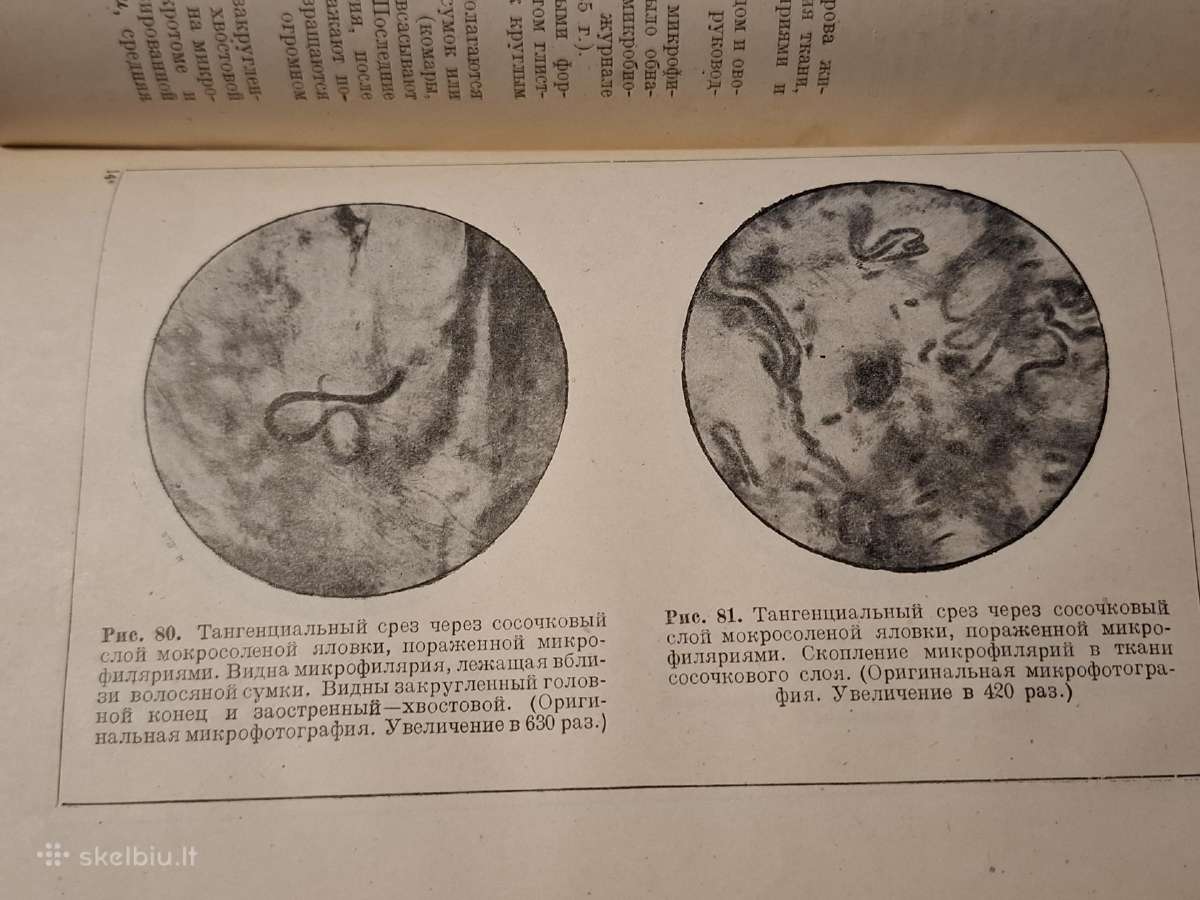 Odos žaliavos mikrobiologija - nuotraukos Nr. 9