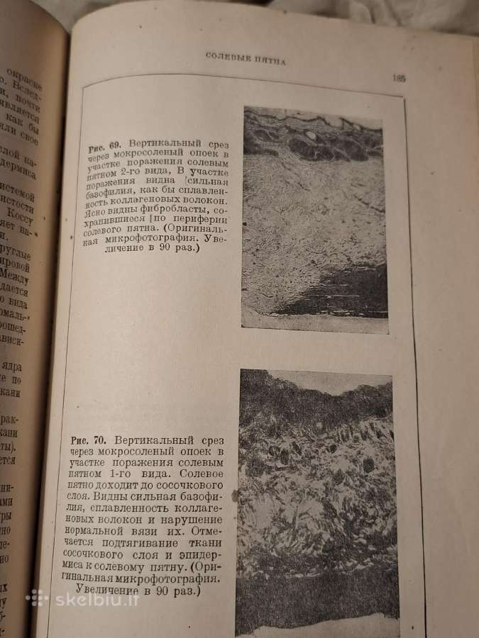 Odos žaliavos mikrobiologija - nuotraukos Nr. 12