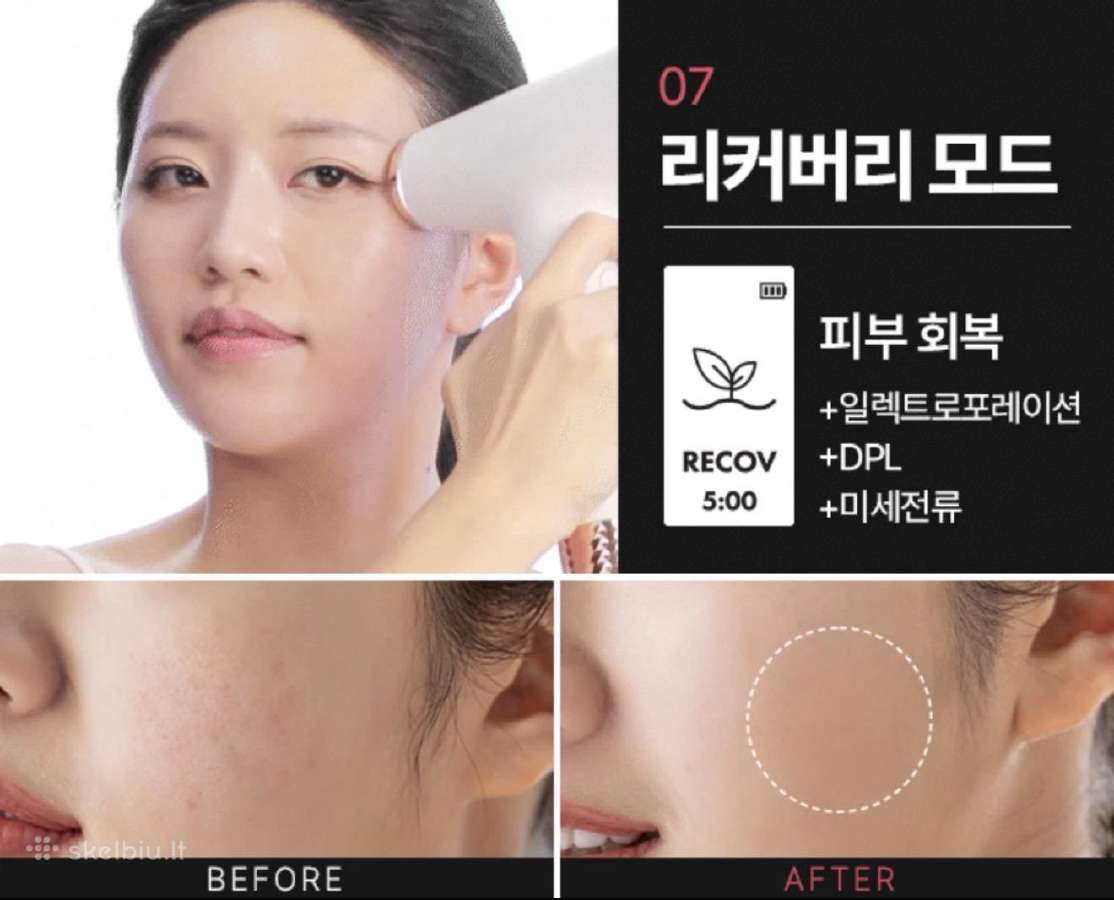 Aalok Ultra Change Focus – Baby Pink Edition - nuotraukos Nr. 8
