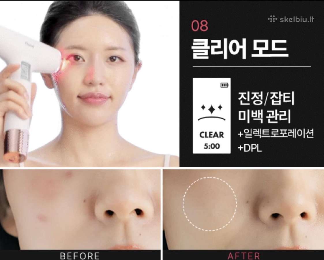 Aalok Ultra Change Focus – Baby Pink Edition - nuotraukos Nr. 9