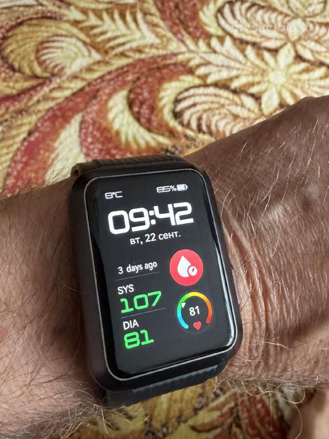 Huawei Watch D - nuotraukos Nr. 2