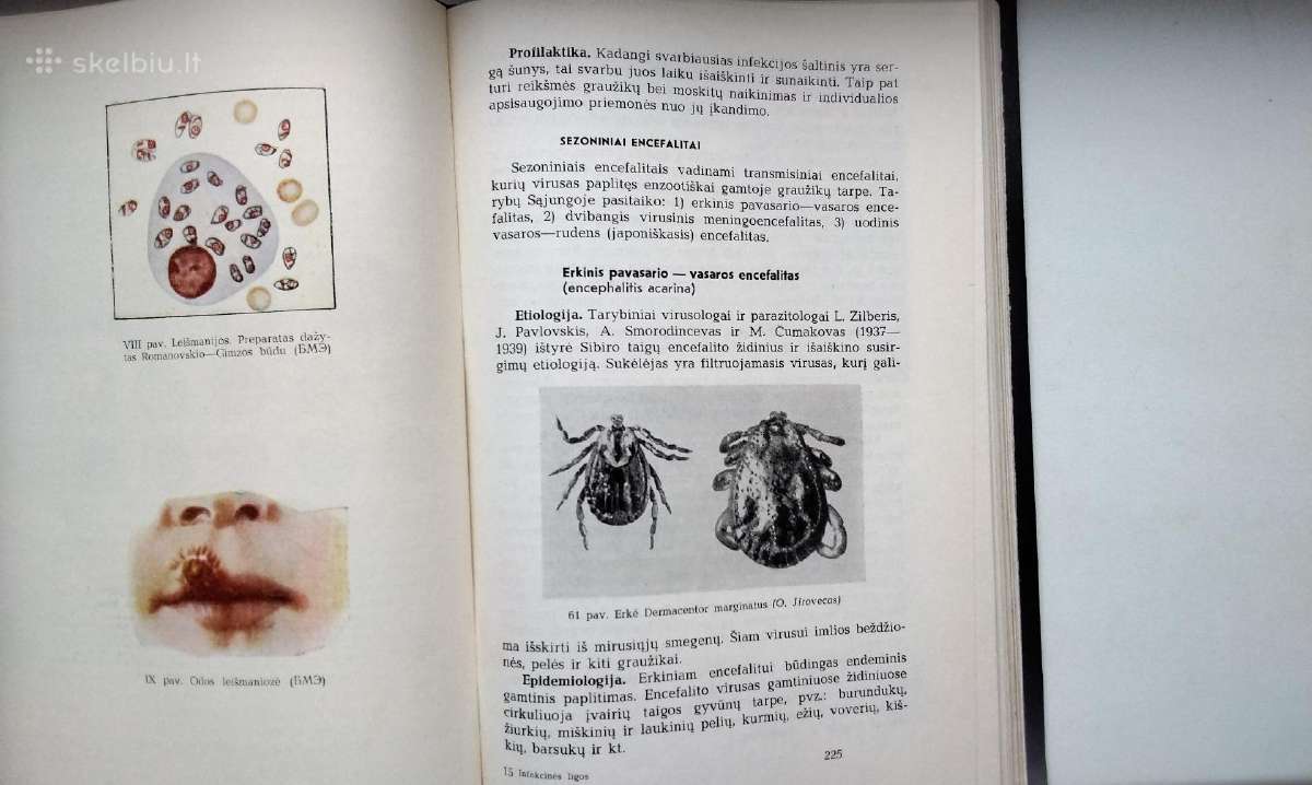 P. Čibiras. Infekcinės ligos. 1966 m. leid. - nuotraukos Nr. 9