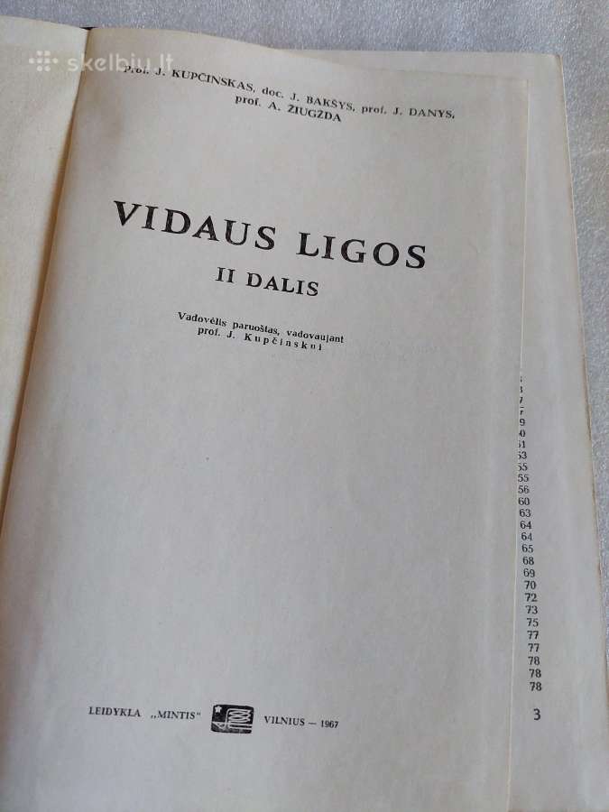 Vidaus ligos - nuotraukos Nr. 7