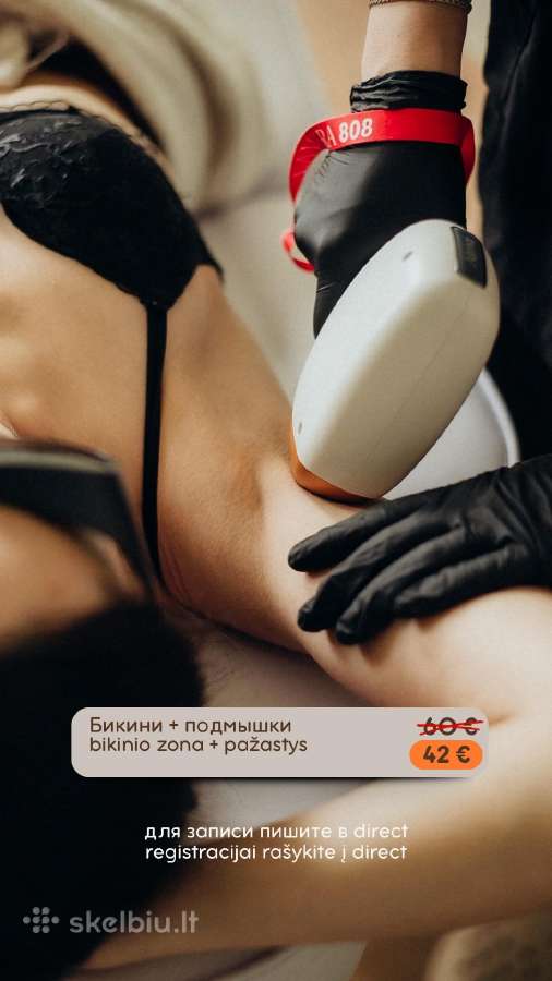 Moterų lazerinė depiliaлазерная эпиляция женская - nuotraukos Nr. 3