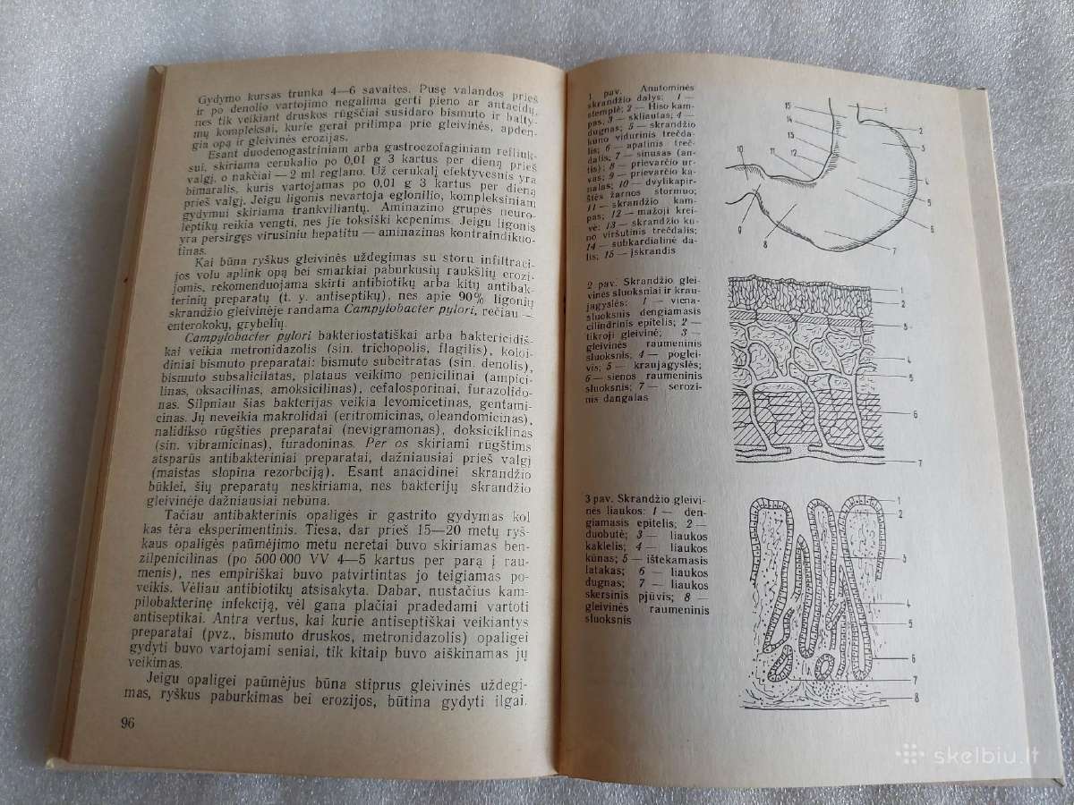 Skrandžio ir dvylikapirštės žarnos ligos - nuotraukos Nr. 3