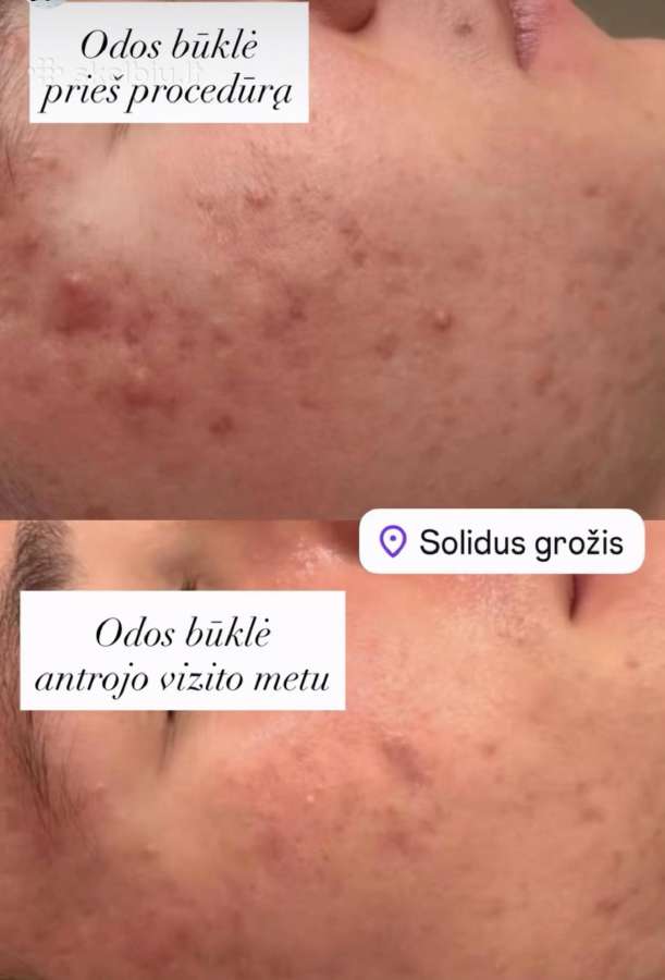 Profesionalios veido ir kūno procedūros! - nuotraukos Nr. 4