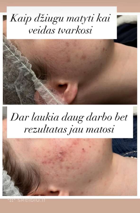 Profesionalios veido ir kūno procedūros! - nuotraukos Nr. 5