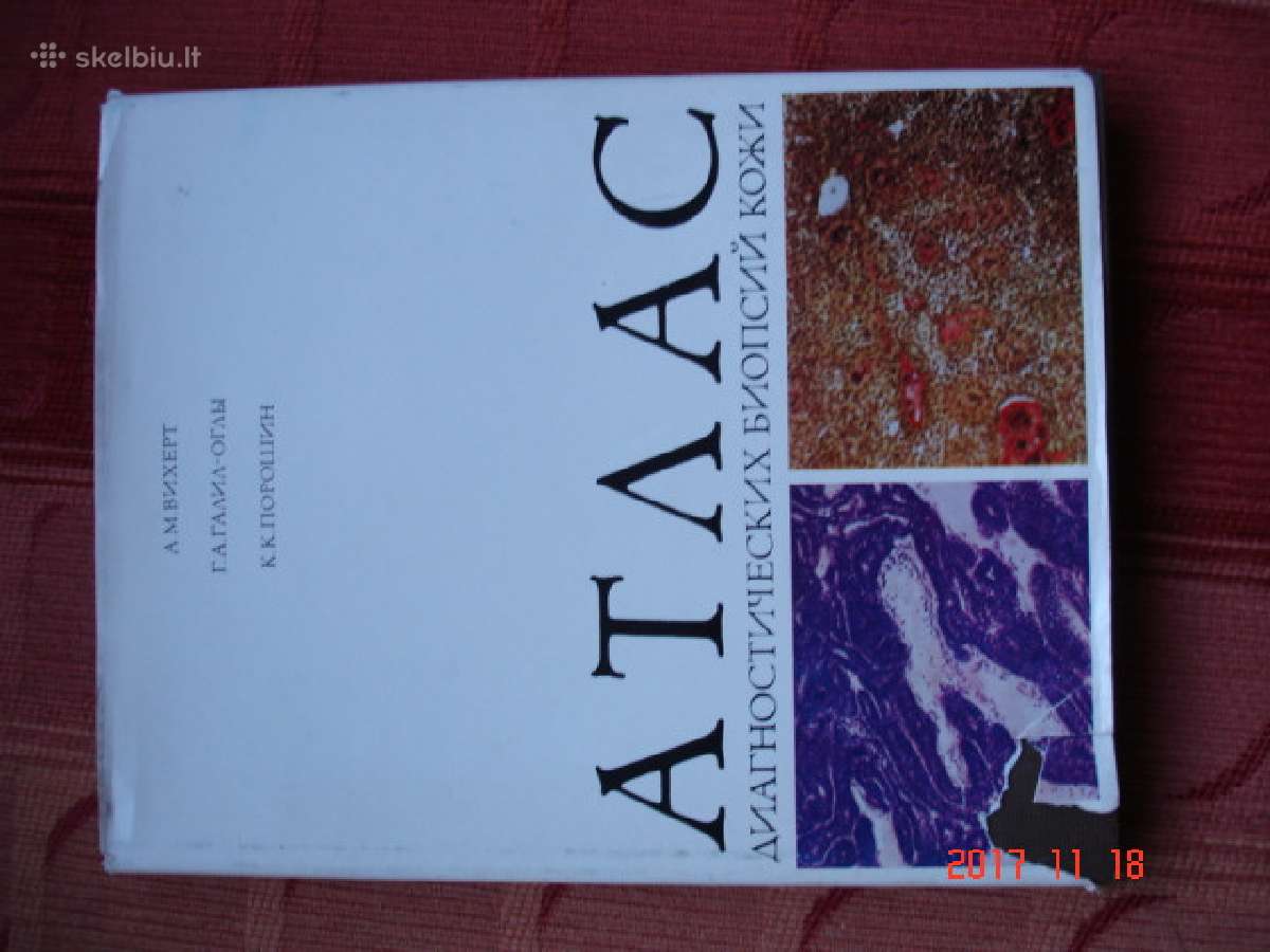 Medicininis atlasas Odos biopsijos diagnostika