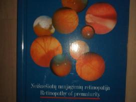Knyga "Neišnešiotų naujagimių retinopatija"