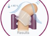 Varpos auginimas, penio ilginimas Pro Extender - nuotraukos Nr. 5