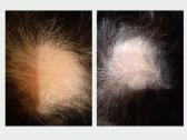 Plaukų kaukė „Hair Mask Alv“- pagalba plaukams - nuotraukos Nr. 6
