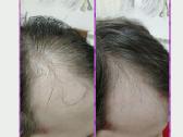 Plaukų kaukė „Hair Mask Alv“- pagalba plaukams - nuotraukos Nr. 2