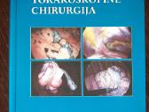 Torakoskopinė Chirurgija