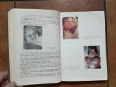 J. Markulis, J. Nainys "Teismo medicina" 1969 m. - nuotraukos Nr. 7