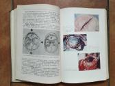 J. Markulis, J. Nainys "Teismo medicina" 1969 m. - nuotraukos Nr. 8