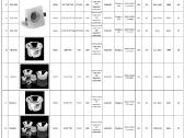 Įleidžiami downlight tipo LED šviestuvai - nuotraukos Nr. 13