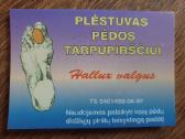 Supinatorius tarpupirštis