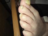 Probleminių nagų bei padų tvarkymas jūsų namuose - nuotraukos Nr. 36