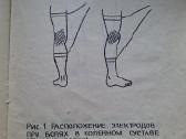 El.stimuliatorius*элиман-206*individual naudojimui - nuotraukos Nr. 5