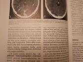 Klinikinė neurologija. 2003m - nuotraukos Nr. 4