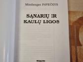 Sąnarių ir kaulų ligos - nuotraukos Nr. 2