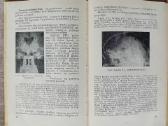 Cerebralinis Arachnoiditas, Urologija - nuotraukos Nr. 3